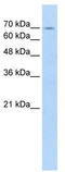 F-Box And Leucine Rich Repeat Protein 5 antibody, TA329815, Origene, Western Blot image 
