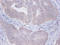 Protein Kinase C Substrate 80K-H antibody, LS-C211731, Lifespan Biosciences, Immunohistochemistry paraffin image 
