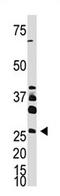 Dickkopf WNT Signaling Pathway Inhibitor 4 antibody, AP11556PU-N, Origene, Western Blot image 