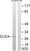 Chloride Intracellular Channel 4 antibody, TA326231, Origene, Western Blot image 