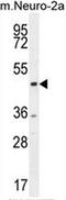 C-Terminal Binding Protein 1 antibody, AP51115PU-N, Origene, Western Blot image 