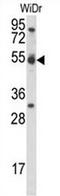Cyclin I antibody, AP50817PU-N, Origene, Western Blot image 