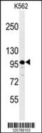 SEZ6L2 antibody, 61-721, ProSci, Western Blot image 