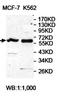 Angel Homolog 2 antibody, orb78029, Biorbyt, Western Blot image 