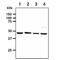 Serine Hydroxymethyltransferase 1 antibody, GTX57666, GeneTex, Western Blot image 