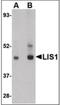 Platelet-activating factor acetylhydrolase IB subunit alpha antibody, NBP1-03125, Novus Biologicals, Western Blot image 
