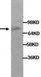 Piwi Like RNA-Mediated Gene Silencing 2 antibody, TA310122, Origene, Western Blot image 