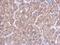 Isocitrate Dehydrogenase (NADP(+)) 2, Mitochondrial antibody, MA5-17271, Invitrogen Antibodies, Immunohistochemistry frozen image 