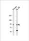Coiled-Coil Domain Containing 144A antibody, PA5-72333, Invitrogen Antibodies, Western Blot image 