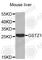 Glutathione S-Transferase Zeta 1 antibody, A6129, ABclonal Technology, Western Blot image 
