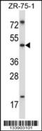 MDM4 Regulator Of P53 antibody, 57-314, ProSci, Western Blot image 