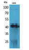 Platelet-derived growth factor D antibody, STJ96664, St John