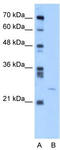 YEATS domain-containing protein 4 antibody, TA329124, Origene, Western Blot image 