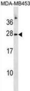 Ribonuclease pancreatic antibody, abx031455, Abbexa, Western Blot image 