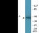 Pim-1 Proto-Oncogene, Serine/Threonine Kinase antibody, EKC2173, Boster Biological Technology, Western Blot image 