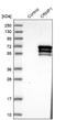 Dihydropyrimidinase-related protein 1 antibody, NBP1-84985, Novus Biologicals, Western Blot image 