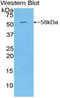 Kallikrein-6 antibody, LS-C294974, Lifespan Biosciences, Western Blot image 