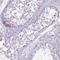 NBPF Member 6 antibody, HPA046411, Atlas Antibodies, Immunohistochemistry frozen image 