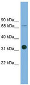 Solute Carrier Family 5 Member 4 antibody, TA333874, Origene, Western Blot image 