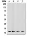 Caspase 3 antibody, MBS821601, MyBioSource, Western Blot image 