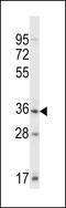 SH3 Domain Binding Kinase Family Member 3 antibody, LS-C203679, Lifespan Biosciences, Western Blot image 