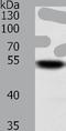 SUFU Negative Regulator Of Hedgehog Signaling antibody, TA324037, Origene, Western Blot image 