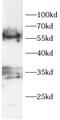 Lysyl Oxidase antibody, FNab10764, FineTest, Western Blot image 
