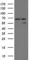 Alpha Fetoprotein antibody, TA501785, Origene, Western Blot image 