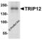 Probable E3 ubiquitin-protein ligase TRIP12 antibody, 7953, ProSci, Western Blot image 