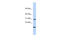 MT-1A antibody, 26-334, ProSci, Enzyme Linked Immunosorbent Assay image 