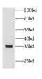 Calponin 1 antibody, FNab01222, FineTest, Western Blot image 