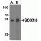 SRY-Box 10 antibody, TA355017, Origene, Western Blot image 