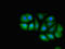 Mediator Complex Subunit 4 antibody, LS-C678631, Lifespan Biosciences, Immunofluorescence image 