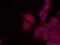 Peroxisomal Biogenesis Factor 5 antibody, 12545-1-AP, Proteintech Group, Immunofluorescence image 