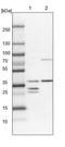Short-chain dehydrogenase/reductase 3 antibody, PA5-52750, Invitrogen Antibodies, Western Blot image 