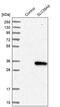 Solute Carrier Family 39 Member 9 antibody, PA5-52485, Invitrogen Antibodies, Western Blot image 