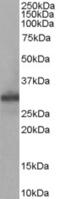 Four And A Half LIM Domains 1 antibody, AHP2070, Bio-Rad (formerly AbD Serotec) , Immunohistochemistry paraffin image 