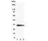 Aquaporin 6 antibody, R31204, NSJ Bioreagents, Western Blot image 