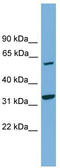 Probable Xaa-Pro aminopeptidase 3 antibody, TA344700, Origene, Western Blot image 