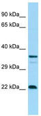 CD83 Molecule antibody, TA343115, Origene, Western Blot image 