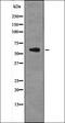 6-Phosphofructo-2-Kinase/Fructose-2,6-Biphosphatase 2 antibody, orb336014, Biorbyt, Western Blot image 