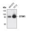 Stromal Interaction Molecule 1 antibody, PA5-17145, Invitrogen Antibodies, Western Blot image 