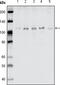 EPH Receptor B1 antibody, M02811, Boster Biological Technology, Western Blot image 