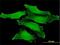 Chloride intracellular channel protein 1 antibody, H00001192-M01, Novus Biologicals, Immunocytochemistry image 