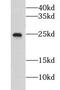 CCHC-Type Zinc Finger Nucleic Acid Binding Protein antibody, FNab01793, FineTest, Western Blot image 
