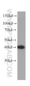Immunoglobulin Binding Protein 1 antibody, 60256-1-Ig, Proteintech Group, Western Blot image 