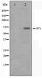 Tumor Protein P73 antibody, TA347531, Origene, Western Blot image 