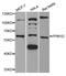 Protein Phosphatase, Mg2+/Mn2+ Dependent 1D antibody, PA5-76866, Invitrogen Antibodies, Western Blot image 