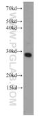Estrogen Receptor Binding Site Associated Antigen 9 antibody, 66170-1-Ig, Proteintech Group, Western Blot image 