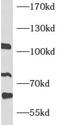Activating Transcription Factor 6 Beta antibody, FNab00665, FineTest, Western Blot image 